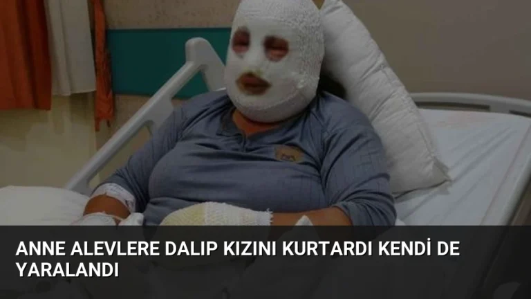 Anne Alevlere Dalıp Kızını Kurtardı Kendi De Yaralandı